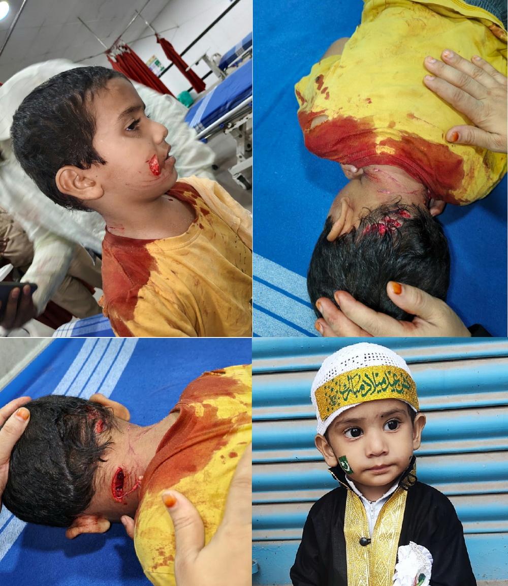 کتوں کے حملے میں چار سالہ بچہ شدید زخمی؛ والدہ کی بروقت مداخلت سے بچ گئی جان