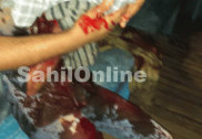 منگلورو میں تین نوجوانوں پرنقاب پوشوں کا حملہ ۔ ایک کی حالت نازک