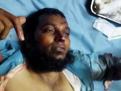 کرناٹک کے  چتردرگہ میں  مسجد سے لوٹ رہےنمازی سمیع اللہ پر جان لیوا حملہ ، حملہ آور گرفتار 