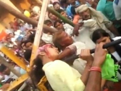 منڈیا : 'آسمانی جھولے' میں پھنسنے سے چمڑی سمیت اکھڑ گئے لڑکی کے بال 
